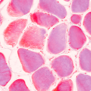 The Rise of Zombie Cells image