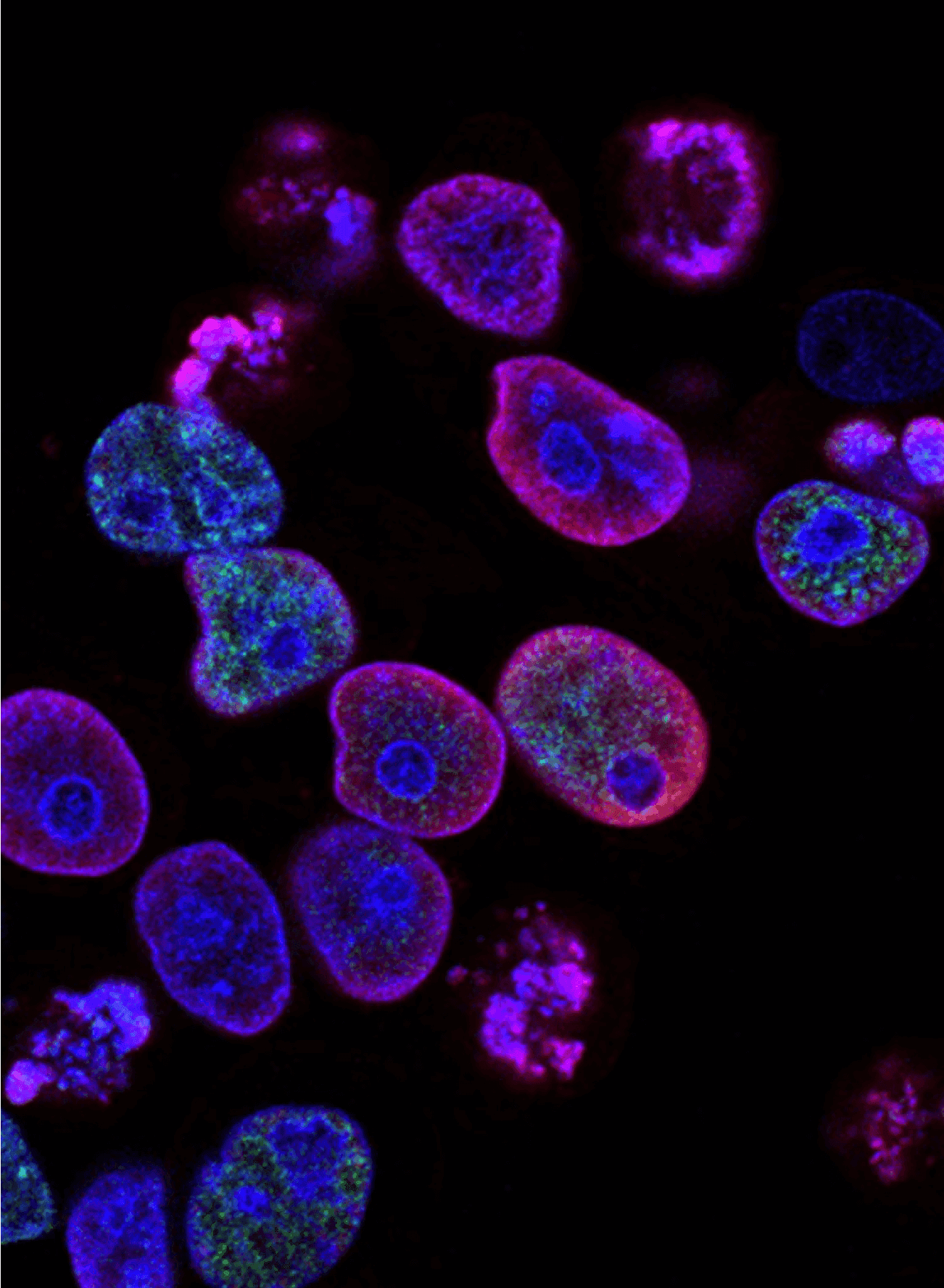 The Science of Cellular Senescence